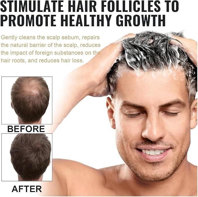 Root Activating Shampoo 200 ml Pack of 2